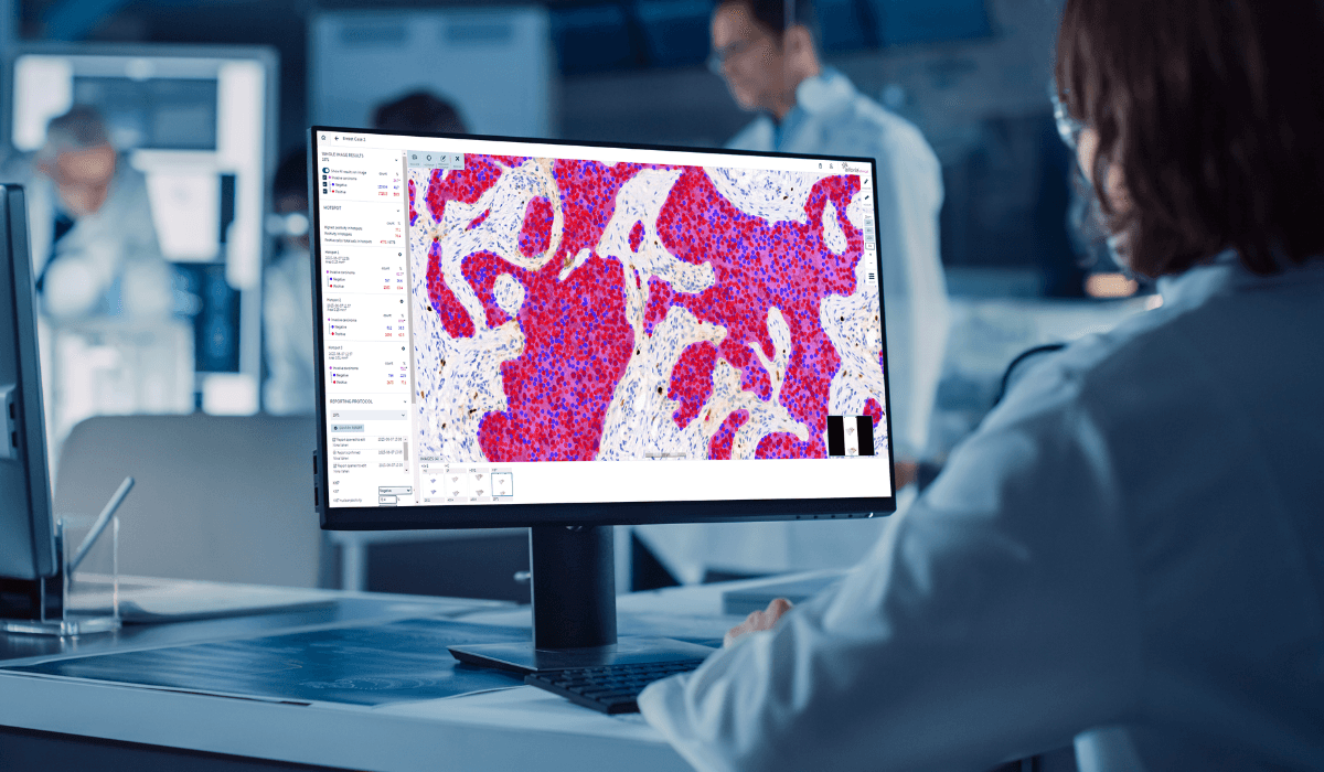 Aiforia Delivers AI-powered Digital Pathology Solutions Through Google ...